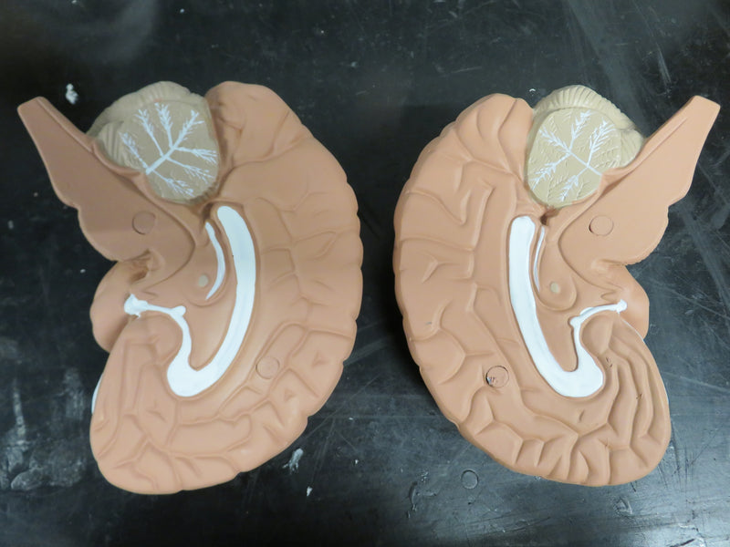 Load image into Gallery viewer, Anatomical model of the human brain (2 parts)